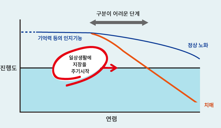 치매 진단